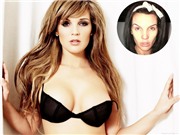 Bóng đá anh, ngoại hạng anh, lịch thi đấu euro 2012, Thảm kịch thẩm mỹ của Danielle Lloyd: Tiên cá hóa xác ve